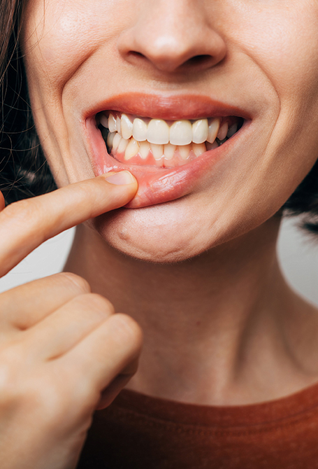 Traitement des gencives Traitement des gencives