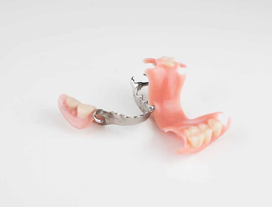 La prothèse amovible partielle