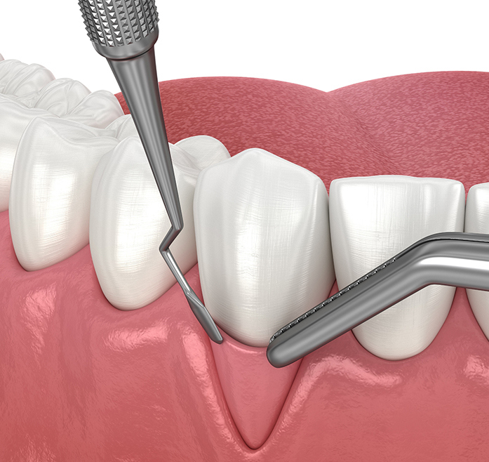 Les types de greffes