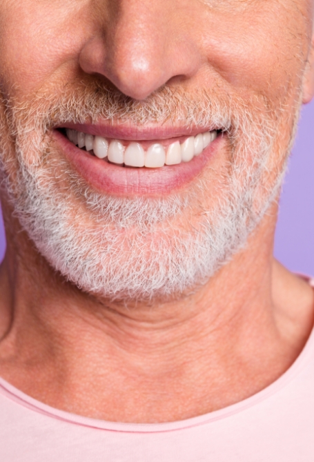 Restaurations sur implants Restaurations sur implants