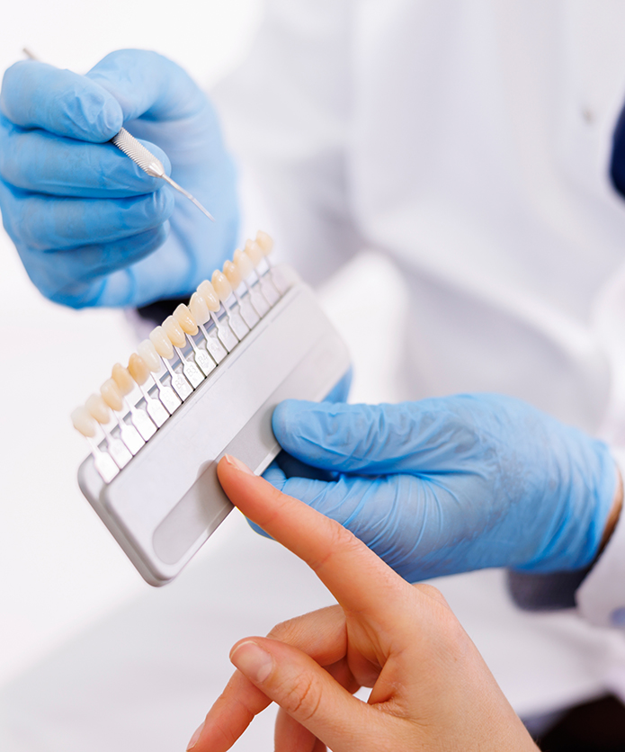 Rôles et avantages des facettes dentaires Rôles et avantages des facettes dentaires